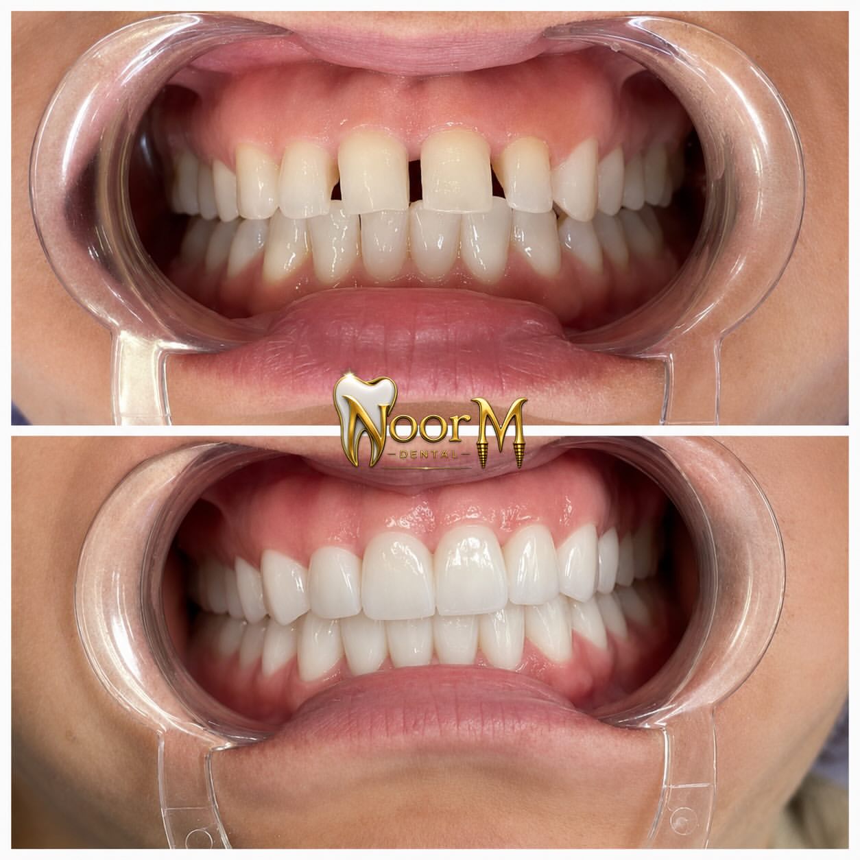 NoorM Dental — pazienti e clinica