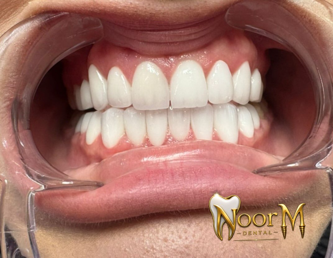 NoorM Dental — pazienti e clinica